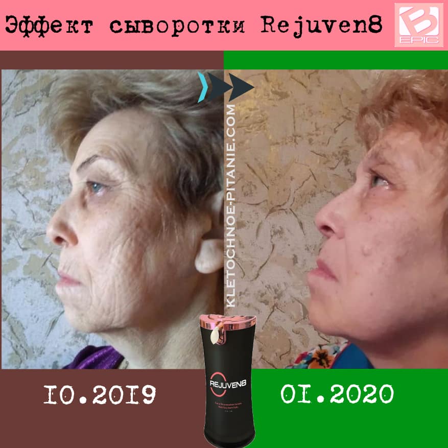 Bepic's Rejuven8 before and after