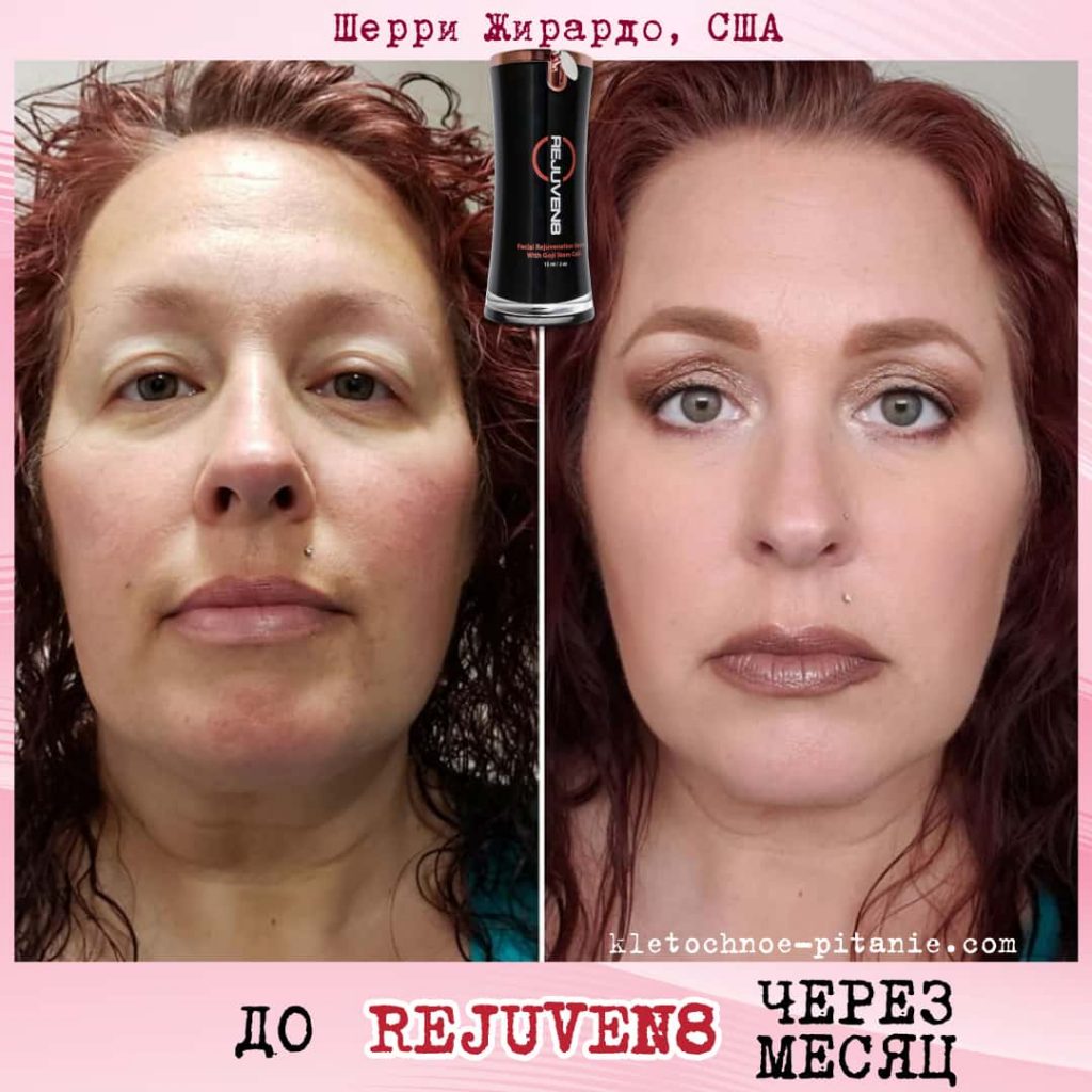 Bepic's Rejuven8 before and after (USA)